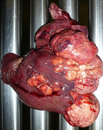 Tumeur du lobe caudal du foie (cliché d'Anthony, 2008)